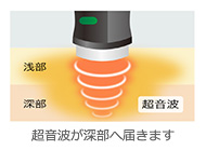 超音波が深部へ届きます