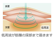 低周波が筋層の深部まで届きます